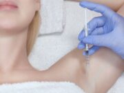 Botoxla Aşırı Terleme Tedavisi